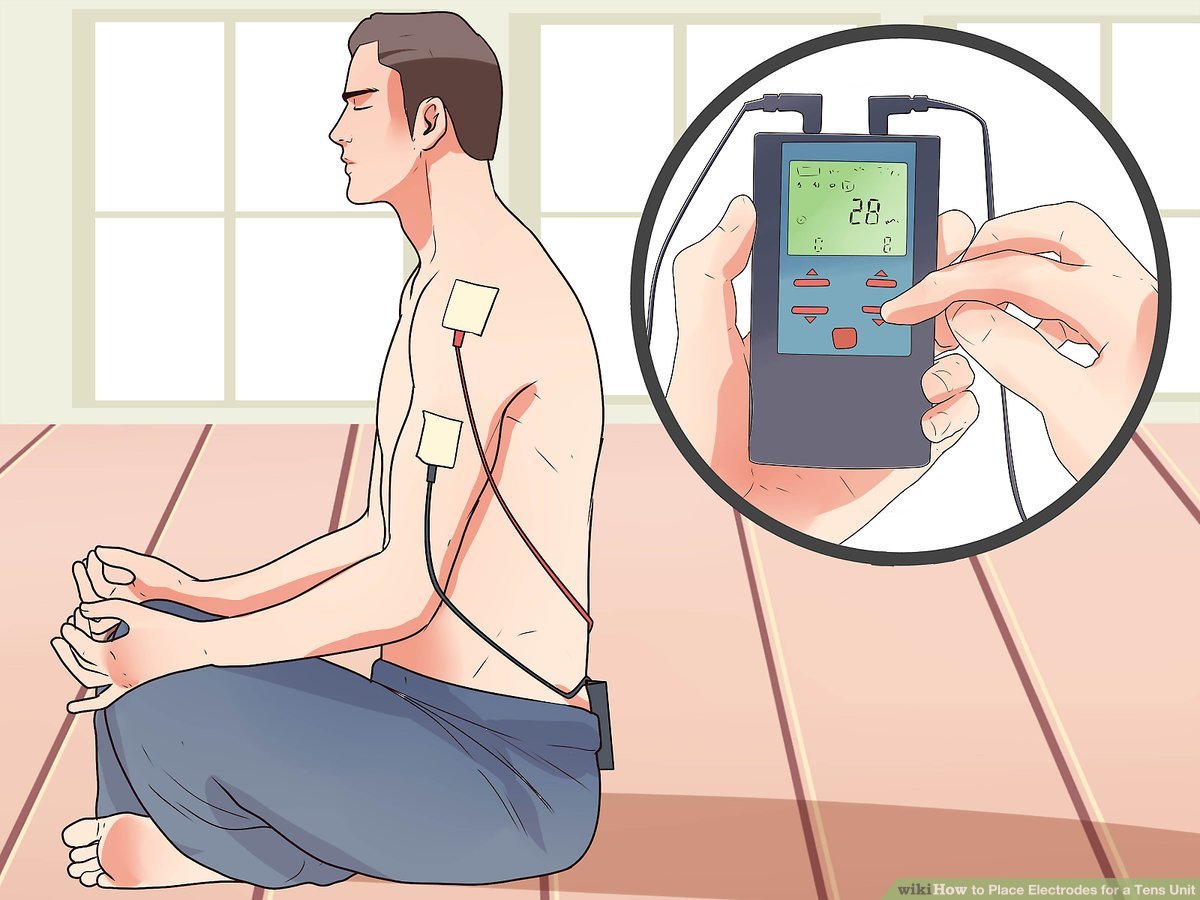 How to Place Electrodes for a Tens Unit